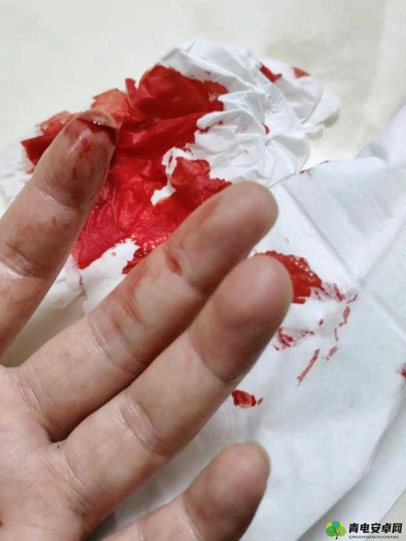 女生喊疼:为什么我总是会在受伤时感到如此疼痛